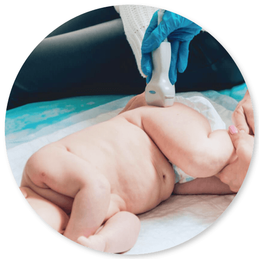 Hip Dysplasia in Babies: Early Screening & Treatment