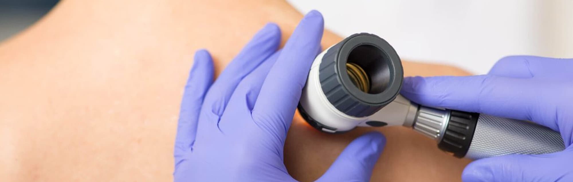 A thorough skin examination