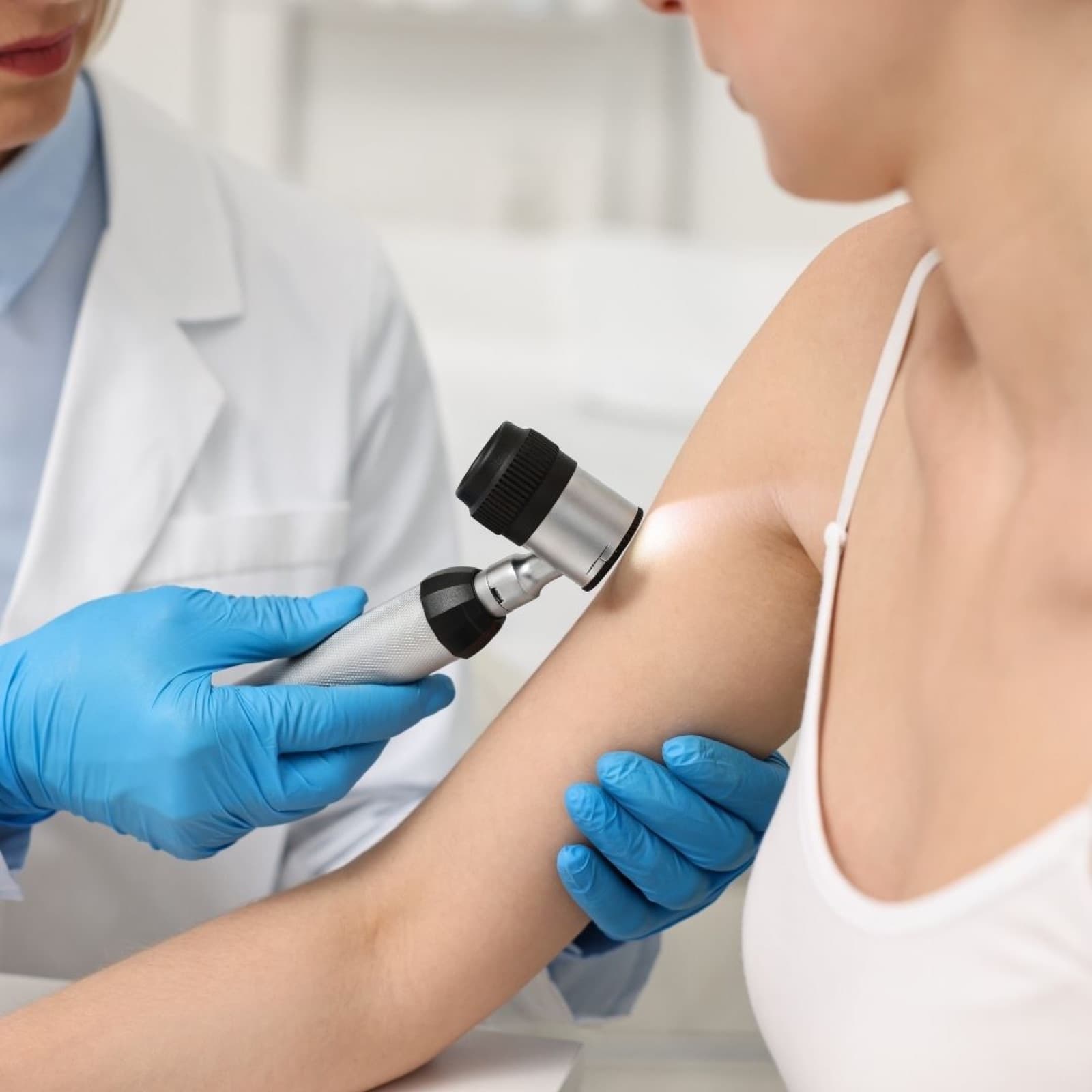 Wart removal at Circle Care