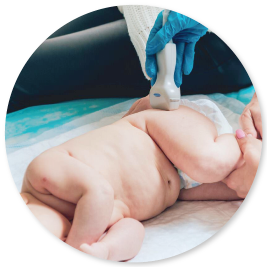 Hip Dysplasia in Babies: Early Screening & Treatment