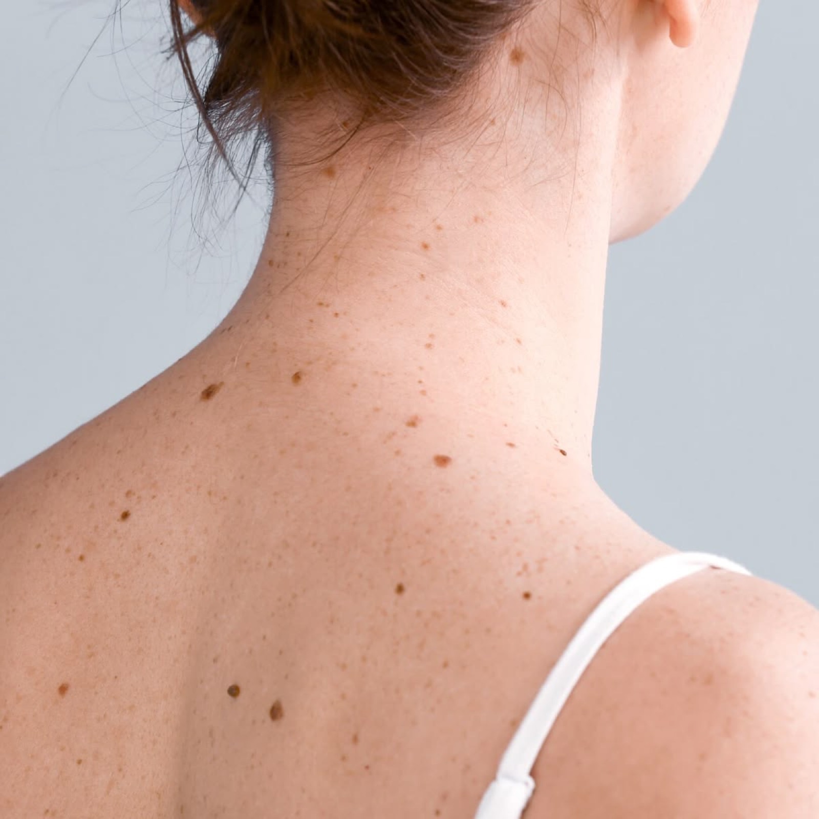 Skin lesion care at Circle Care