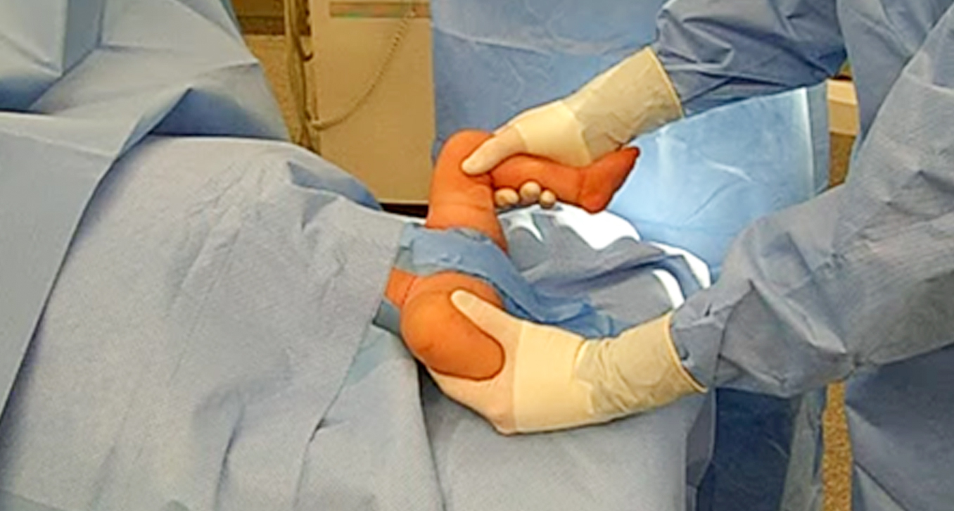 Hip Dysplasia - HIP Screen 10 aaa 1